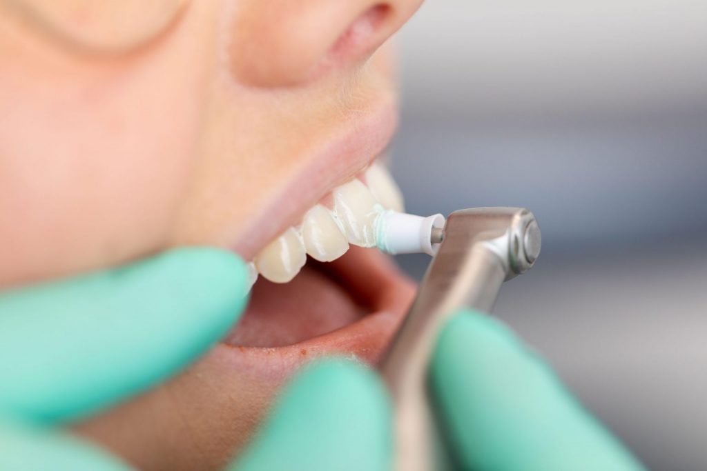 Broken dentures repair