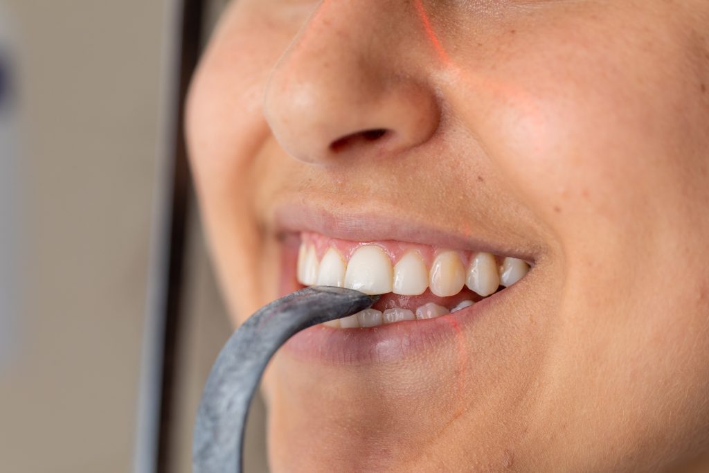 dental crowns and bridges