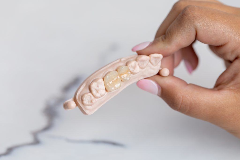 Teeth