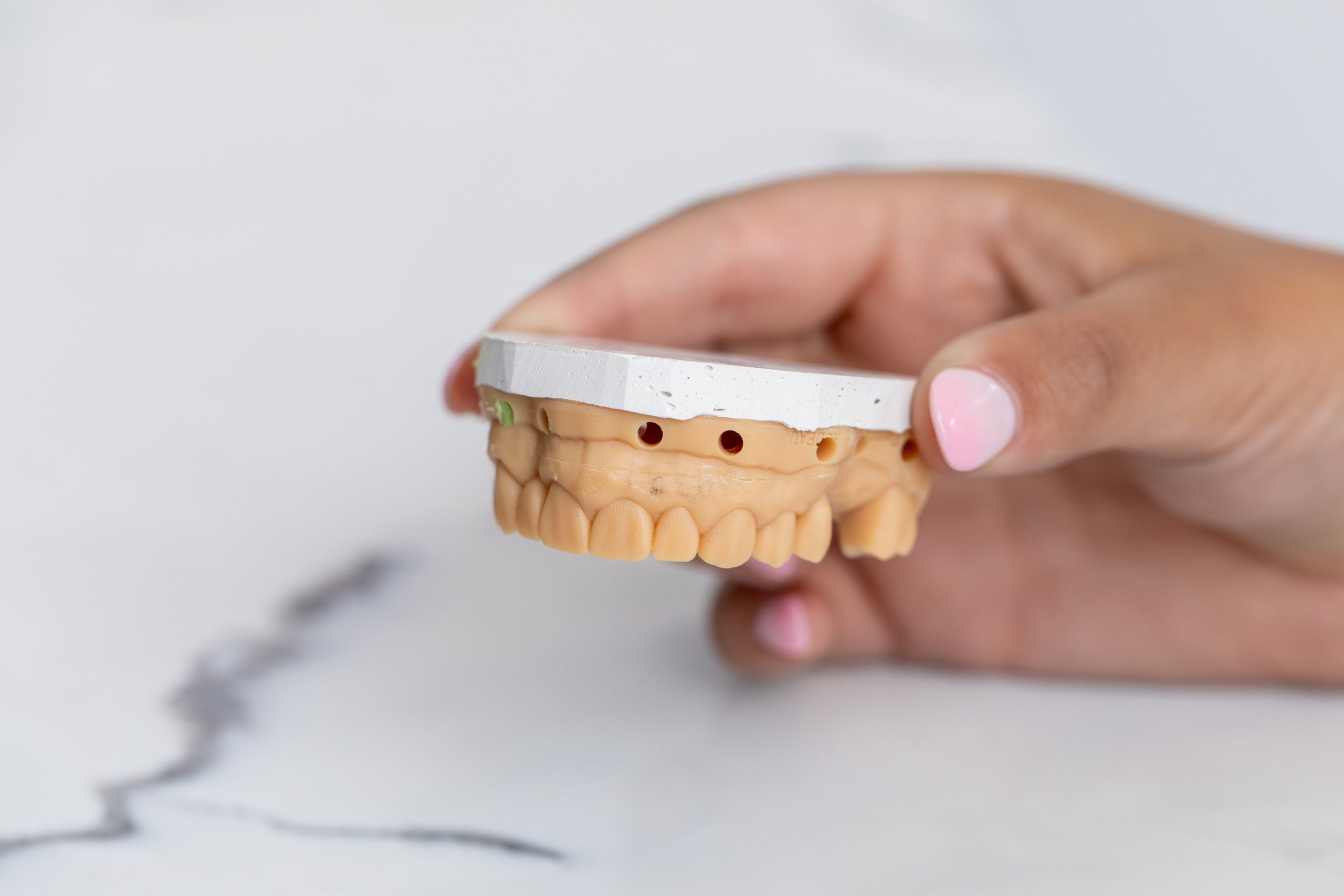 Gum Infection Treatment Gum Grafting Cost Melbourne