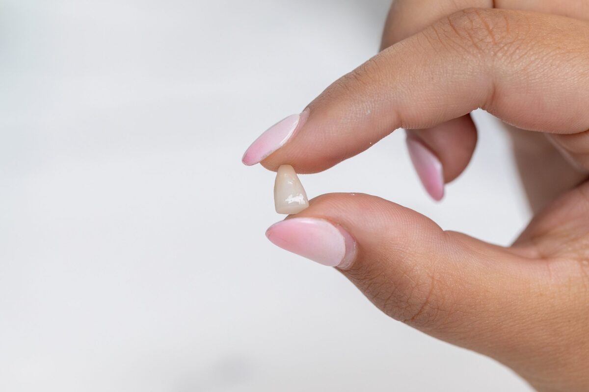 gum grafts | Studio Smiles gum grafts