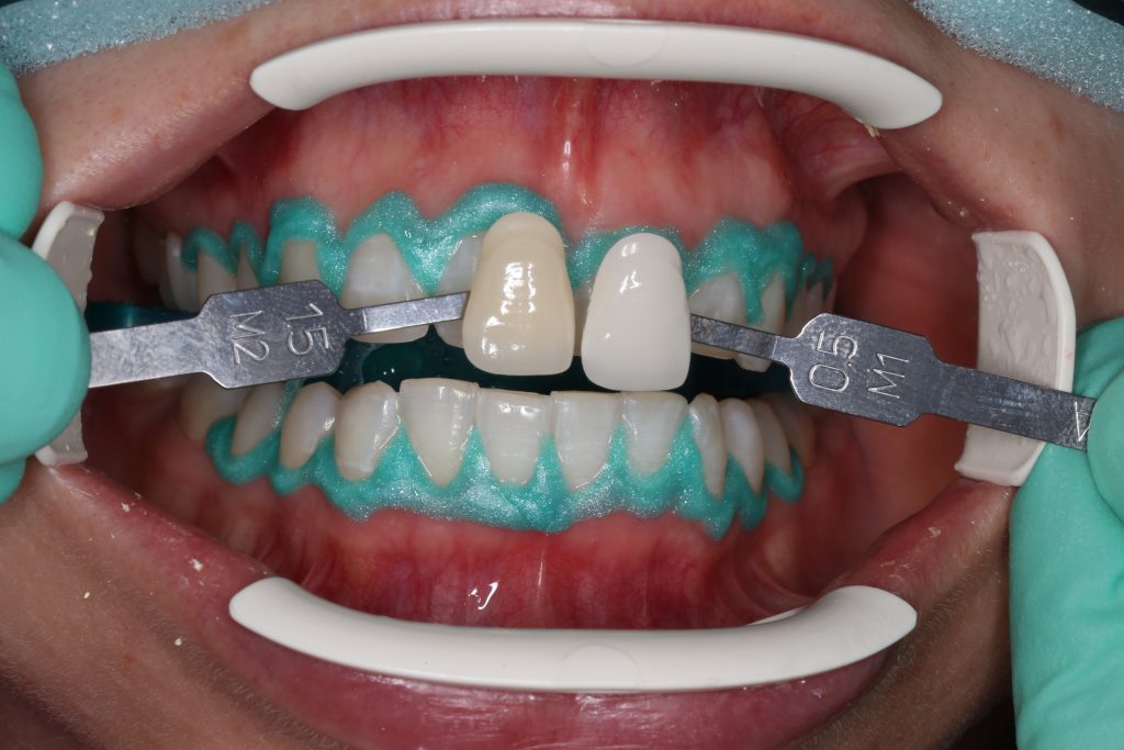 cosmetic dentistry | Studio Smiles cosmetic dentistry