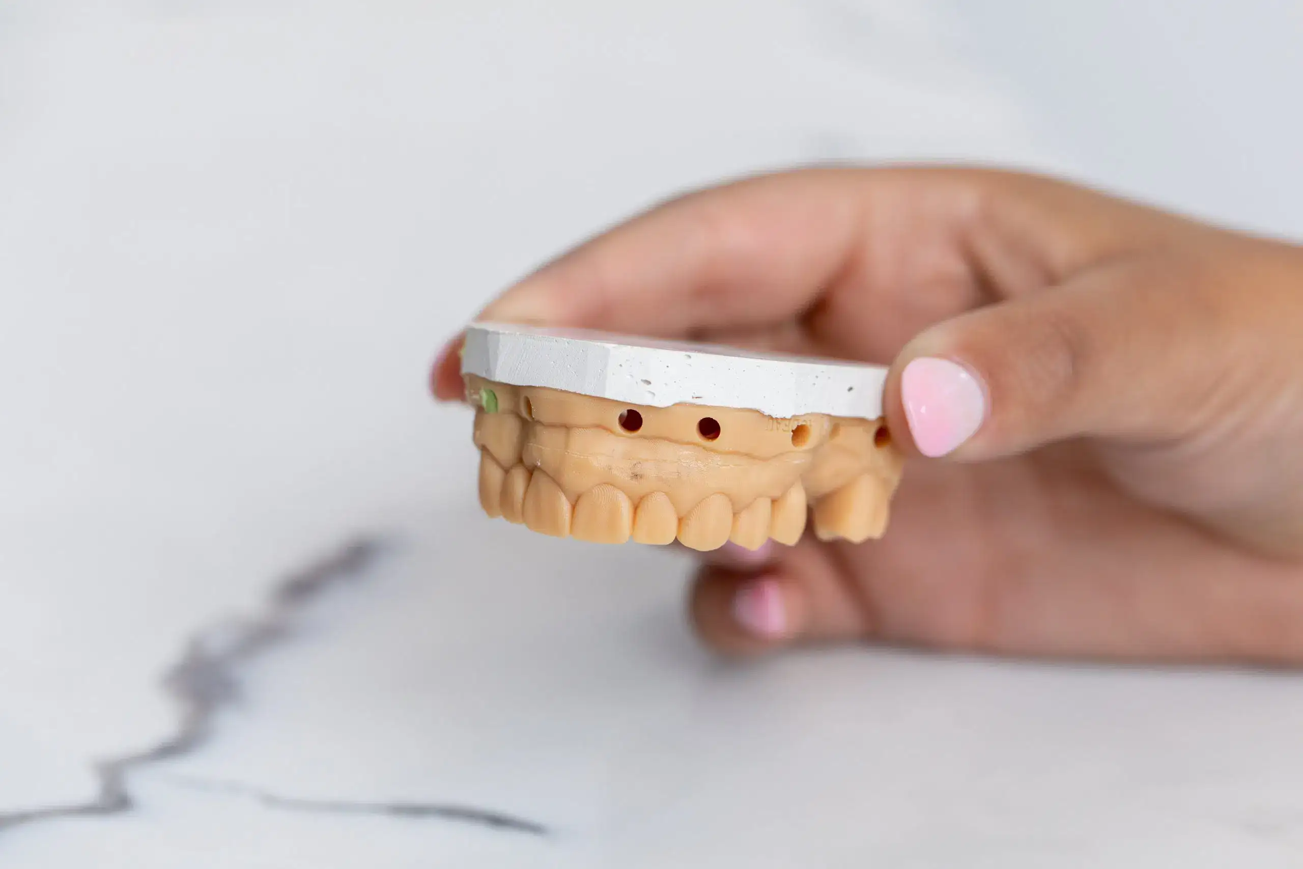 gum grafting | Studio Smiles gum grafting