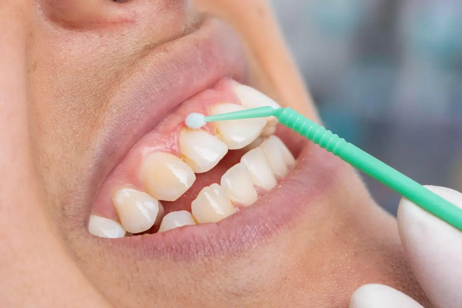 transformation journey | Studio Smiles transformation journey