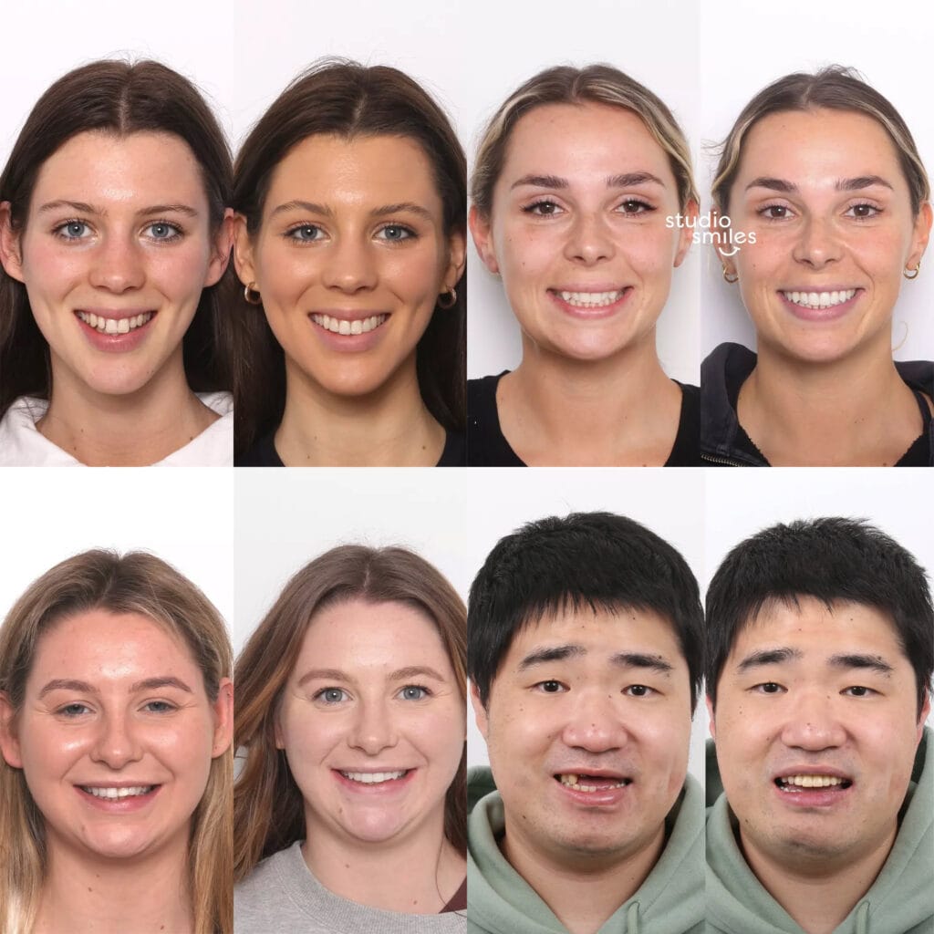Main Web Banner Final Studio Smiles | Studio Smiles
